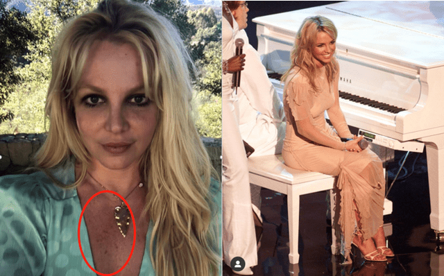 小甜甜布兰妮近况曝光,穿露脐装惊现色斑,头发凌乱与台上差别大_天后