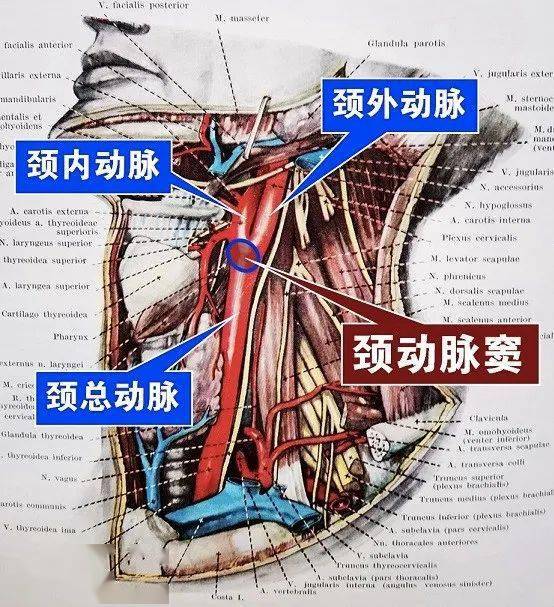 颈动脉窦解剖位置图片