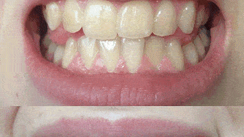 牙缝里|「牙齿橡皮擦」?一刷香口、黄渍消，二刷牙齿白如雪！