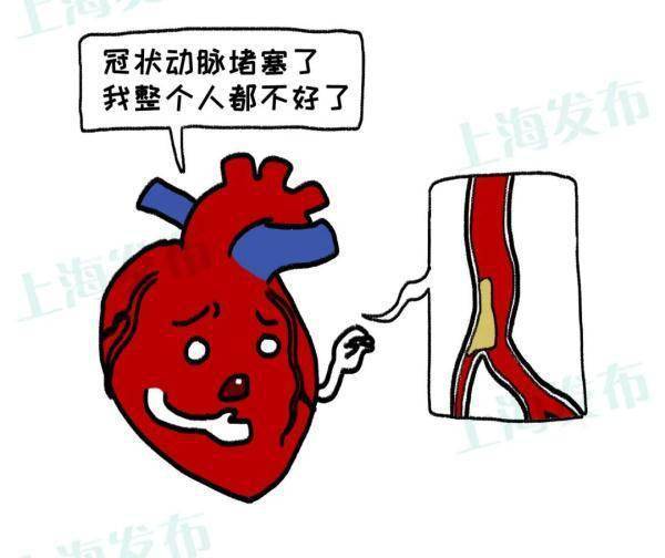 症状|@三高人群，怎样远离心梗/脑梗的威胁？