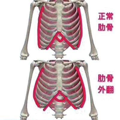 王雪燕最近,王女士发现自己两岁的宝宝肋骨外翻,上网一查,缺钙,佝偻病