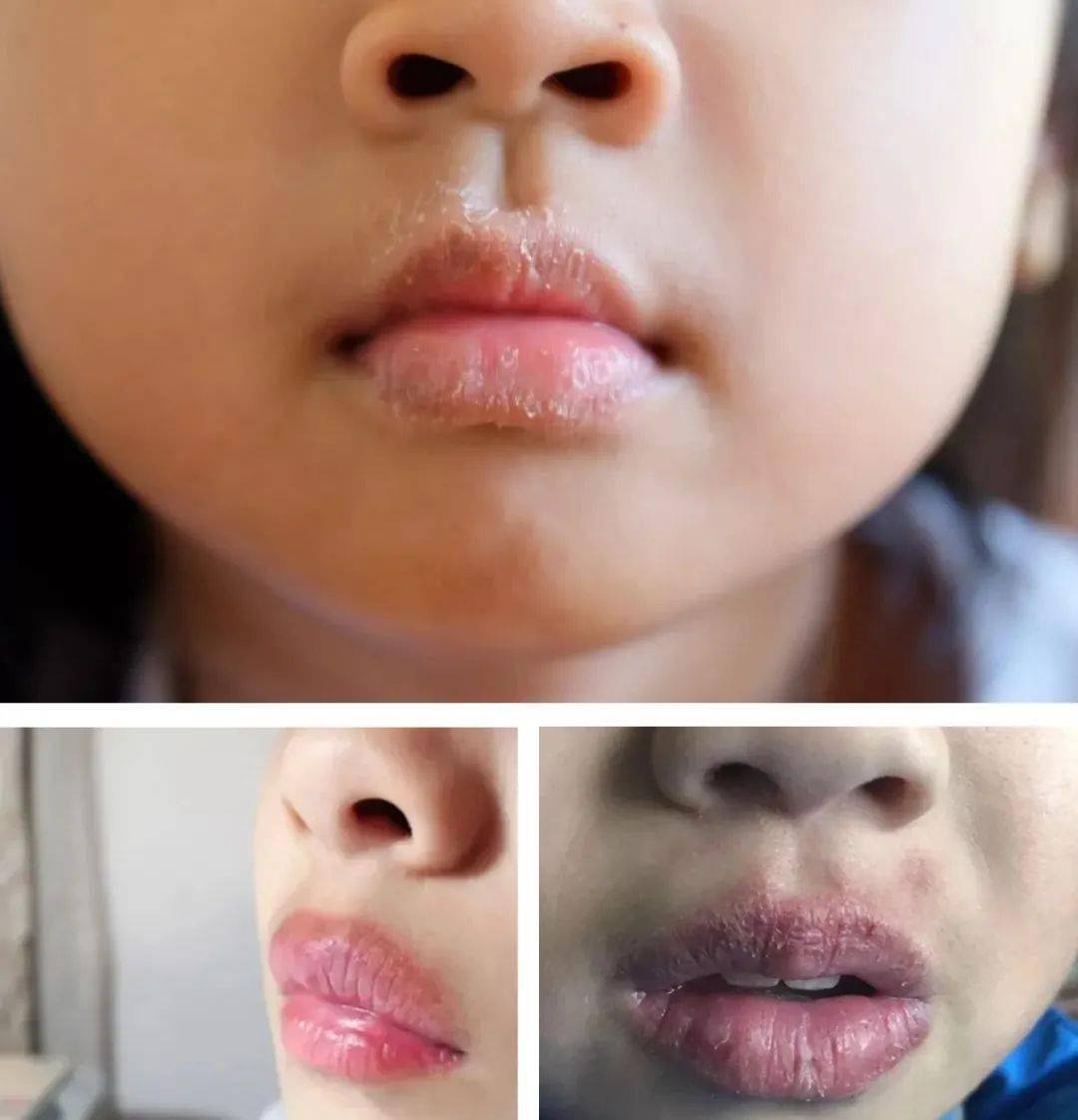 柳州广播严选孩子抢着用的棒棒糖型润唇膏安全到可以舔一涂一抹小嘴儿