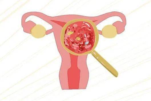 滴虫性阴道炎对女性的危害_寄生_外阴_性交