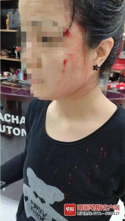 南宁一女子在超市逃单被抓，竟扇员工耳光还划伤他人！