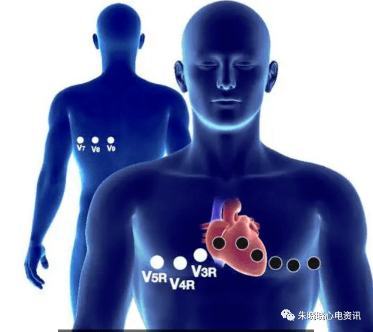 动态心电图报告解读 af07d3120a0c4fa388cd979a36ddc651.png