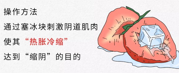 由于成本极低很多人跟风尝试发现好像还真能缩真相是阴道周围的筋膜软