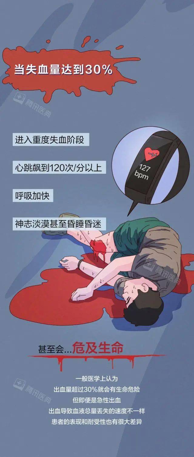 武宜和|用漫画告诉你：人止不住的大出血，到底有多可怕？