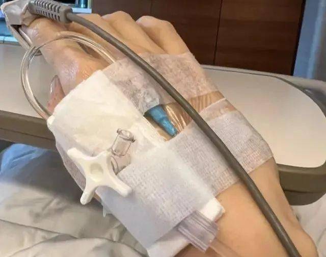 李嘉欣病重进icu抢救48小时躺病床上面容憔悴自称捡回一命