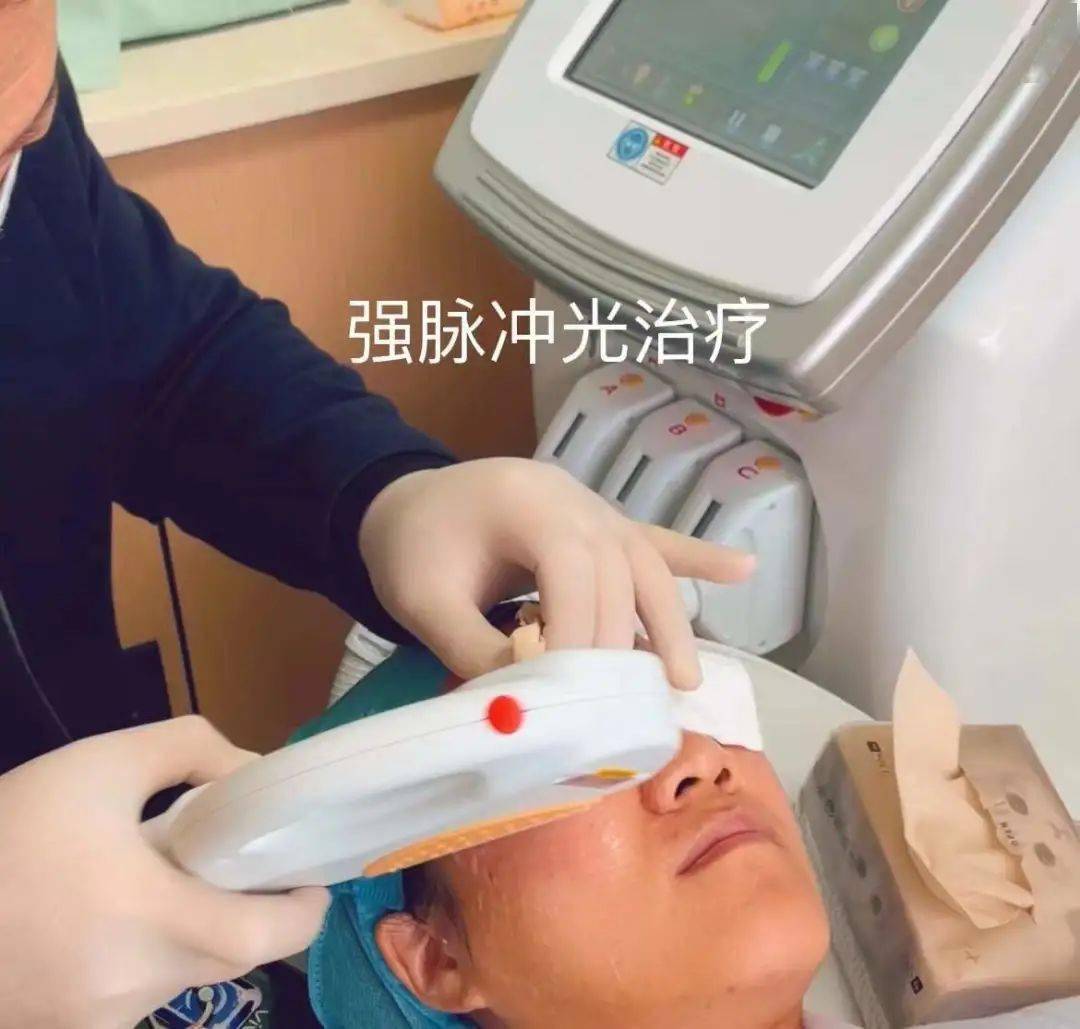 药物治疗:1,茶树精油眼贴或眼膏;2,局部抗炎抗菌滴眼液;3,人工泪液