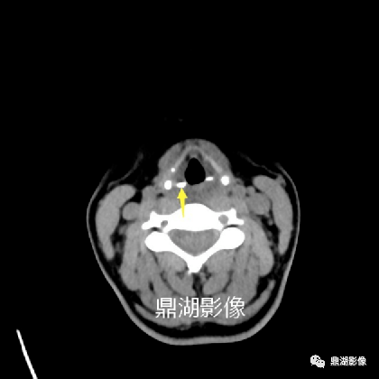 全网最全断层解剖识图题(技师、主管技师)_答案_结构_箭头