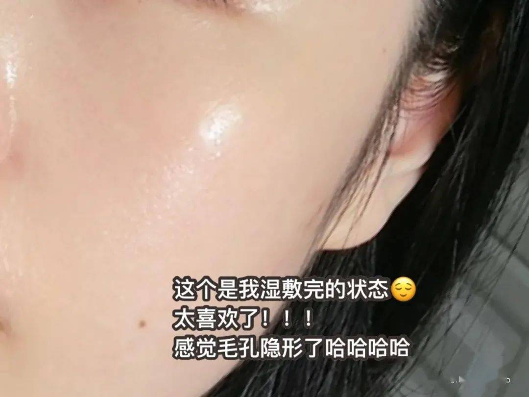 黑头翻车震惊全网的阿娇，高调复出后脸都变了？？？