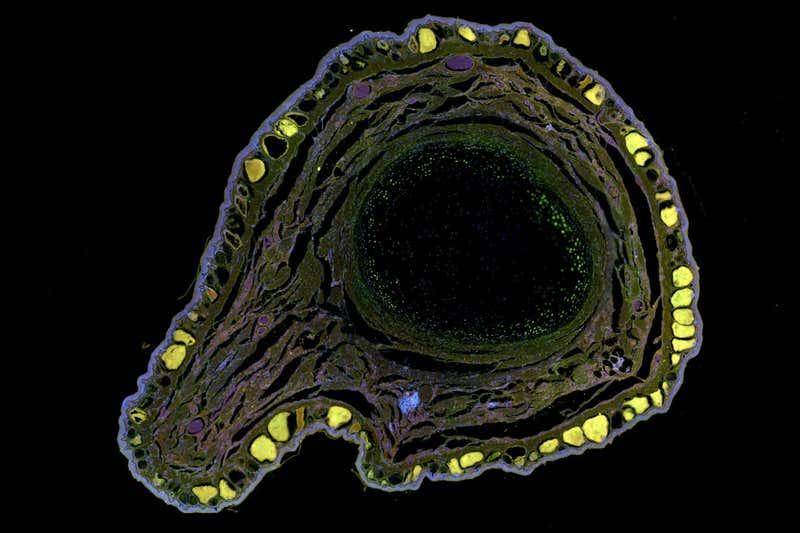 细胞|触发“休眠”细胞，只需用药24小时 青蛙就长出新肢 人类还远吗？