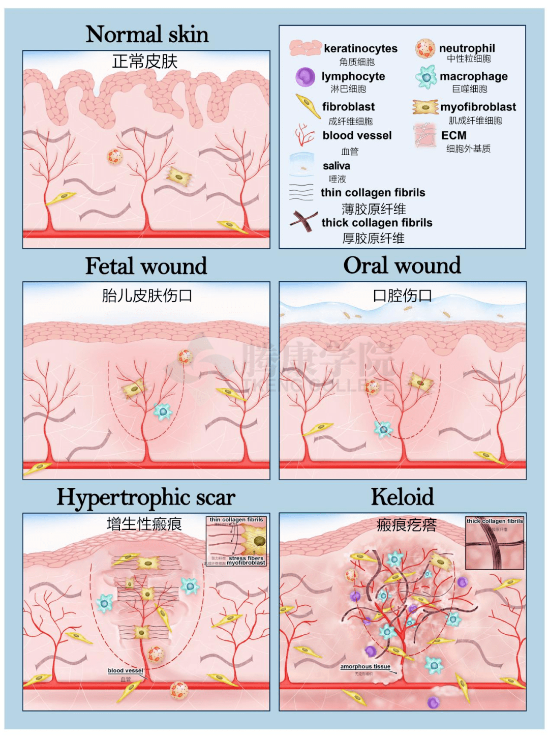 瘢痕| 無疤皮膚創傷癒合和病理性瘢痕_傷口_口腔_炎症