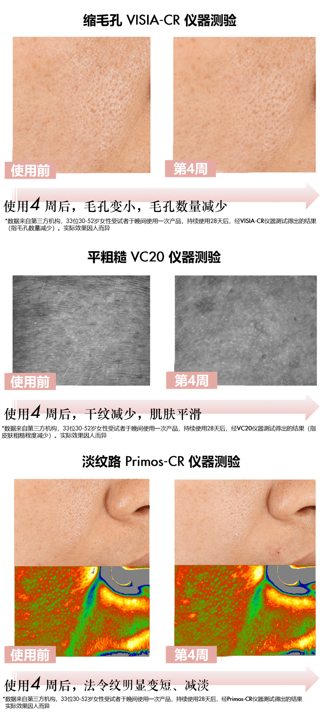 智商烂脸还是换脸？正确刷A才能拿捏粉嫩肌！