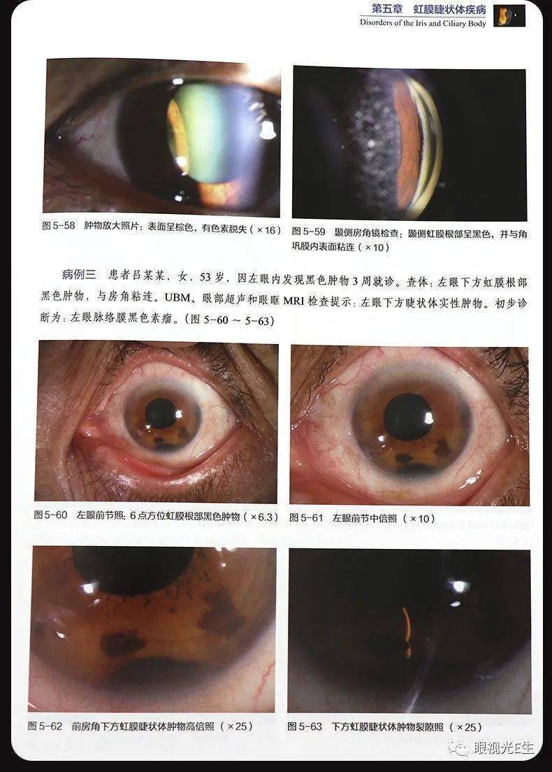 魏文斌眼部裂隙灯生物显微镜图谱
