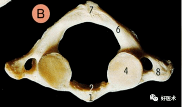 前結節(1),前弓,齒凹(2)兩側為側塊,側塊上面有上關節凹(5)與枕骨形成