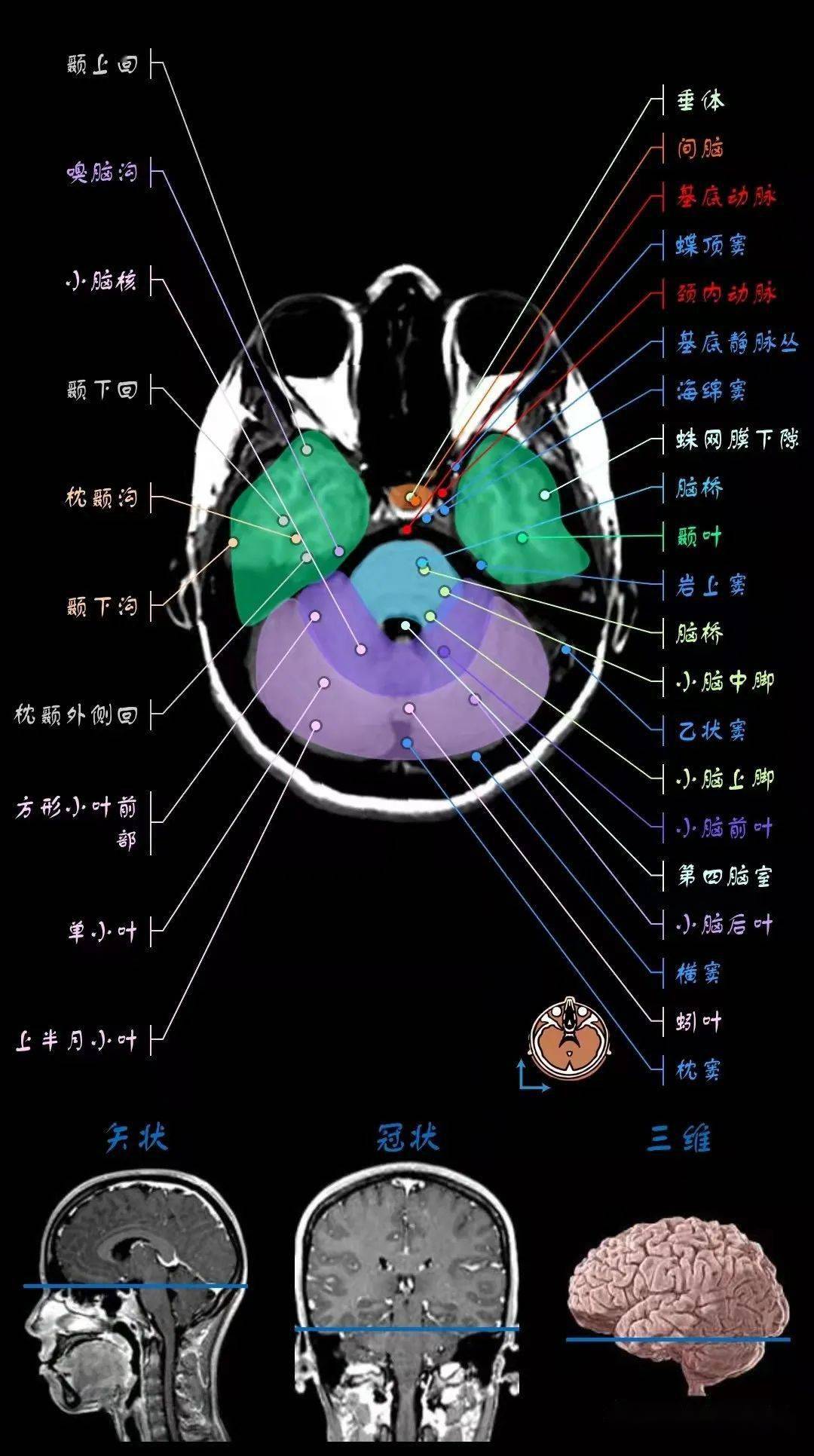 颅脑mri超详细三维标注(最新版)