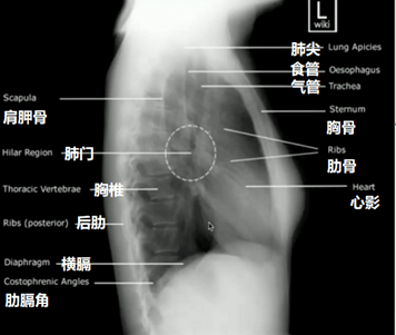 正位(后前位)胸片解剖结构阅读胸片需要多个视角,以下图示标识了正位