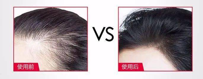 因为散着头发睡觉更健康？99%的女生都做错了，难怪头发油腻还脱发！