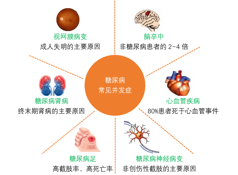 糖尿病导致的周围神经病变