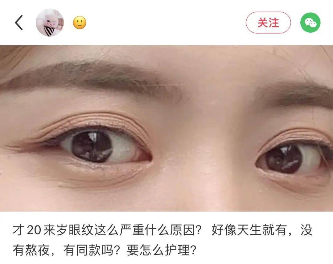 贵妇她眼睛怎么这样？娜B才20岁啊，这也太冤了吧…