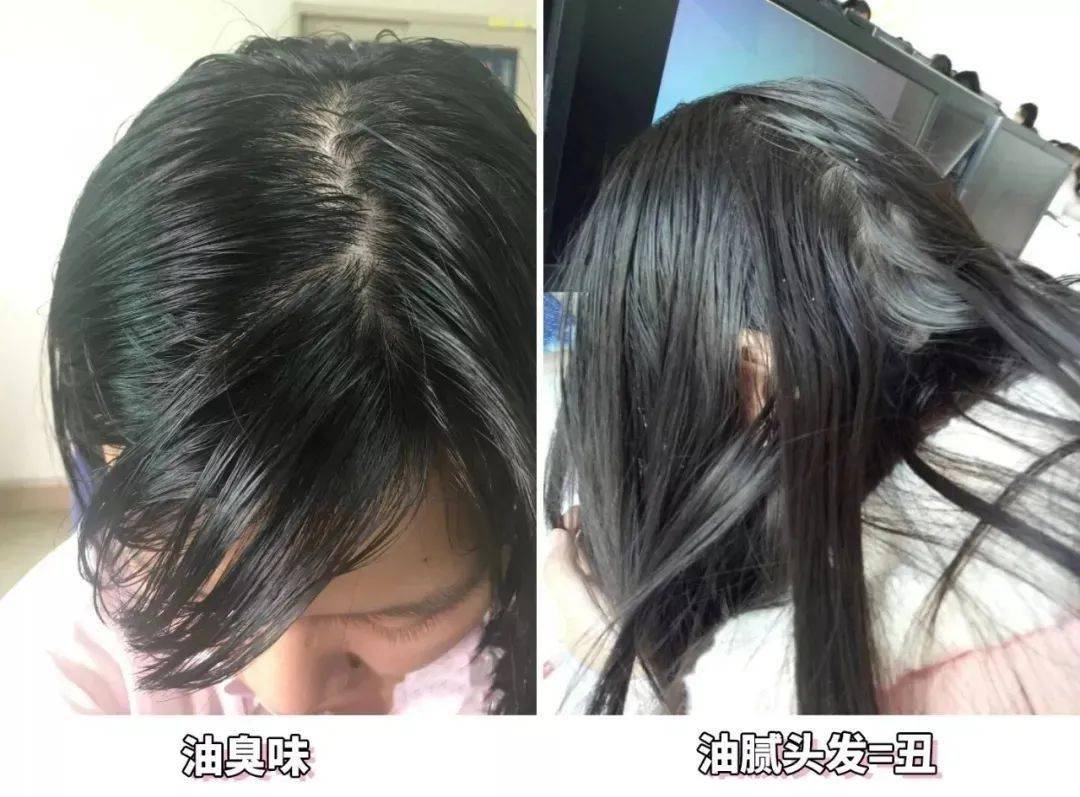 头皮头屑暴增？头皮扣下“白泥”？用Ta,帮你揪出头屑“内鬼”！清爽柔顺，发量翻一番！