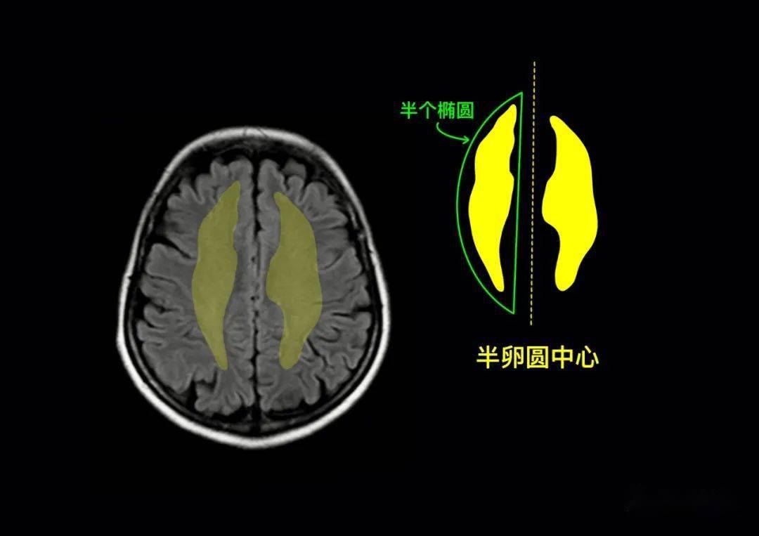 超人气大神版手绘神经影像解剖既美又实用