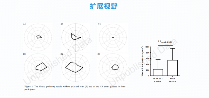 卓教授分析,ar智能眼镜在青光眼管状视野患者视觉辅助效果明显,但是