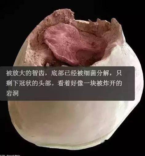 放大1000倍的牙齿太可怕了!看过你肯定会好好刷牙了!_口腔_牙刷_错误