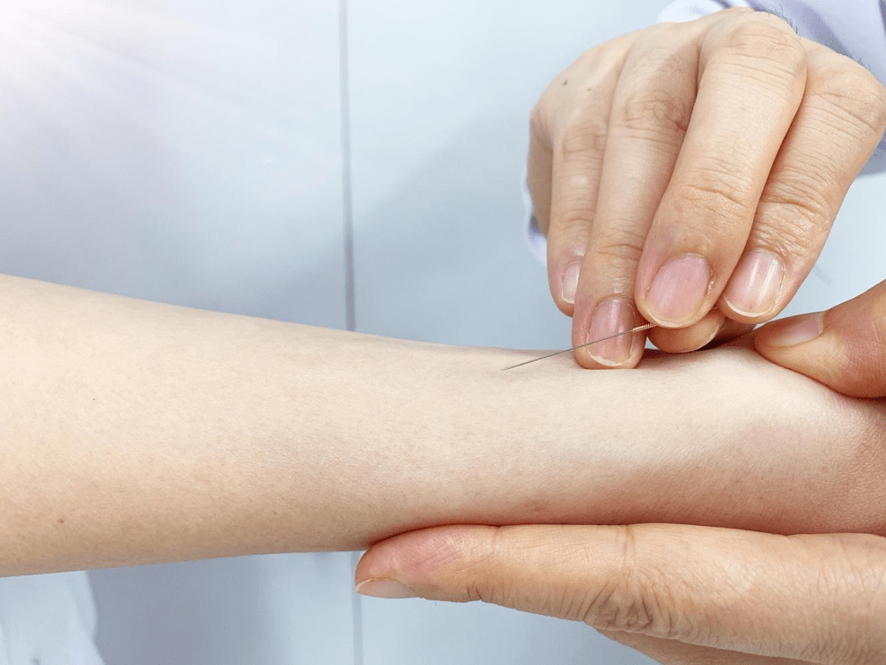 腕踝针耳穴贴压指针疗法注重中西医结合在急危重症疾病中的应用.