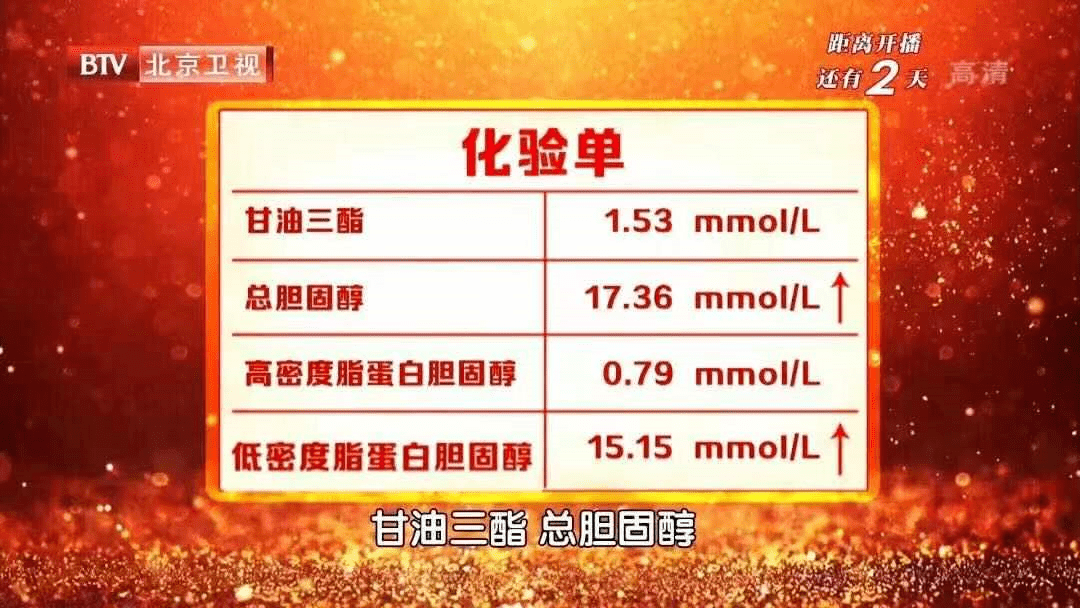 血脂报告单一般包括四个指标:总胆固醇,甘油三酯,低密度脂蛋白胆固醇