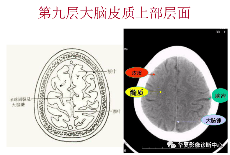 大脑|“九层颅脑”影像