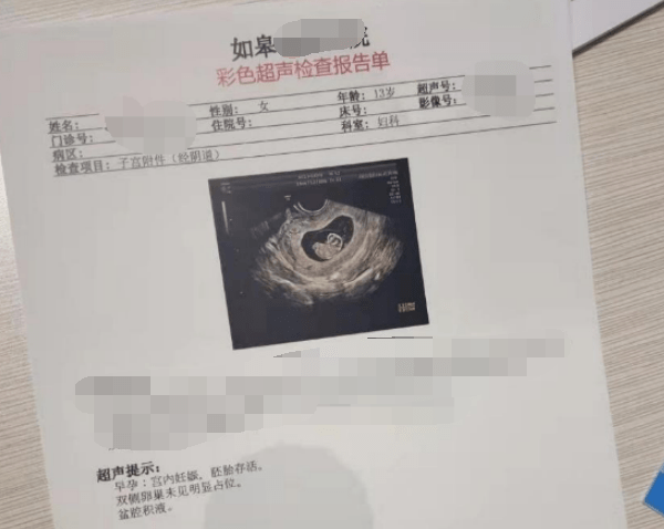 4个月怀孕彩超图片图片