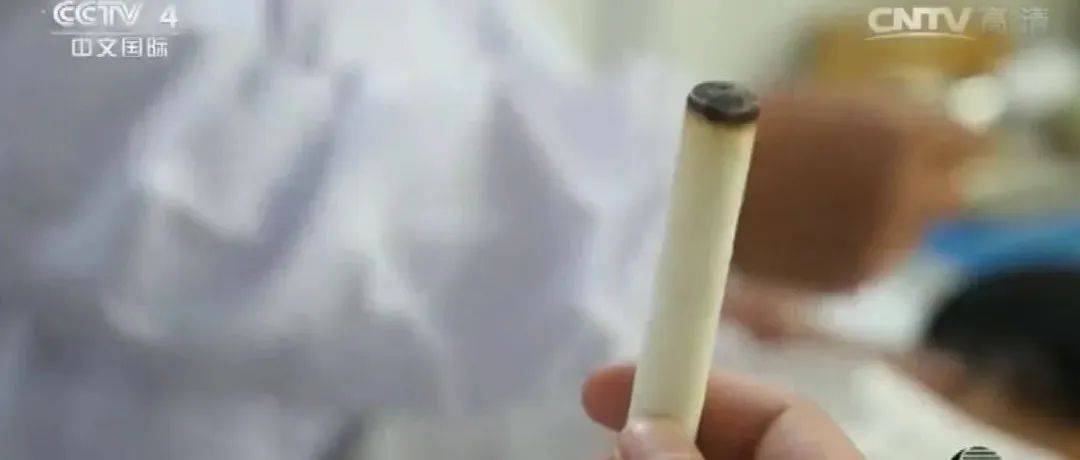 吹灸加放血，顽固化脓性中耳炎的调理_艾灸_治疗_方法