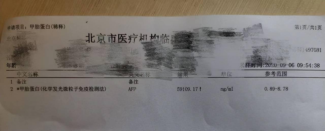 甲胎蛋白afp：59109.17现在也会为吃什么，吃多少而纠结。以前没看中医的时