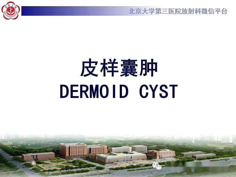 皮样囊肿dermoidcyst