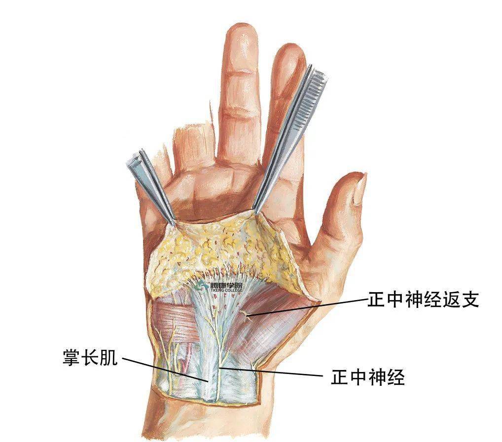 腕部正中神经解剖图片图片