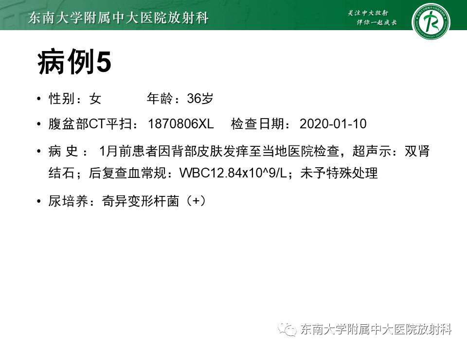 髓質海綿腎影像診斷