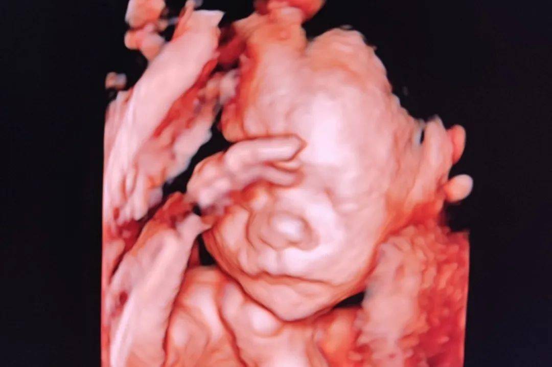 【科普】胎儿的第一张照片——四维超声