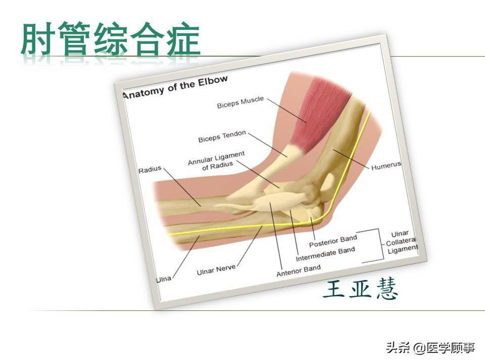 肘管综合征解剖图图片