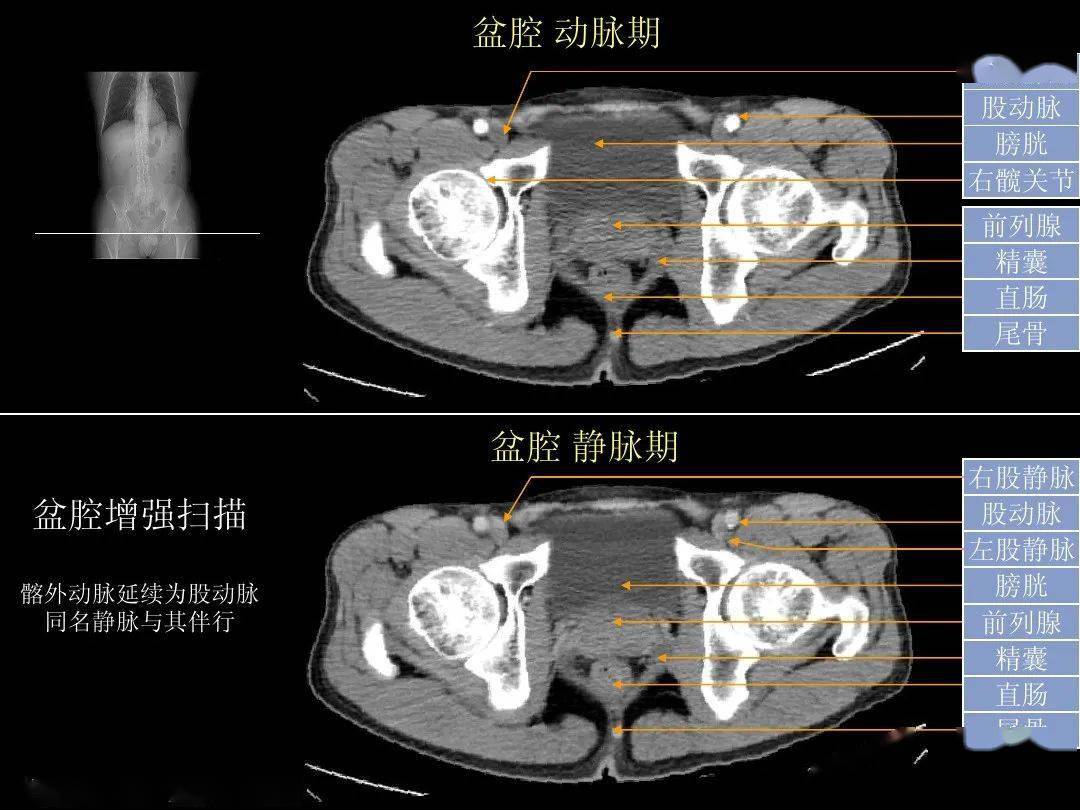 超细的腹部ct入门精美解剖图谱