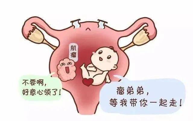 子宮肌瘤很可怕?聽聽它的告白_治療_症狀_什麼