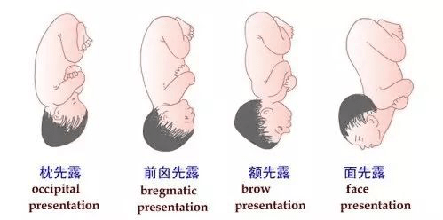 最先進入骨盆入口平面的胎兒部位稱胎先露.