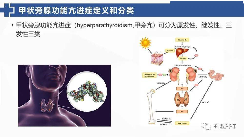 ppt甲状旁腺功能亢进的护理