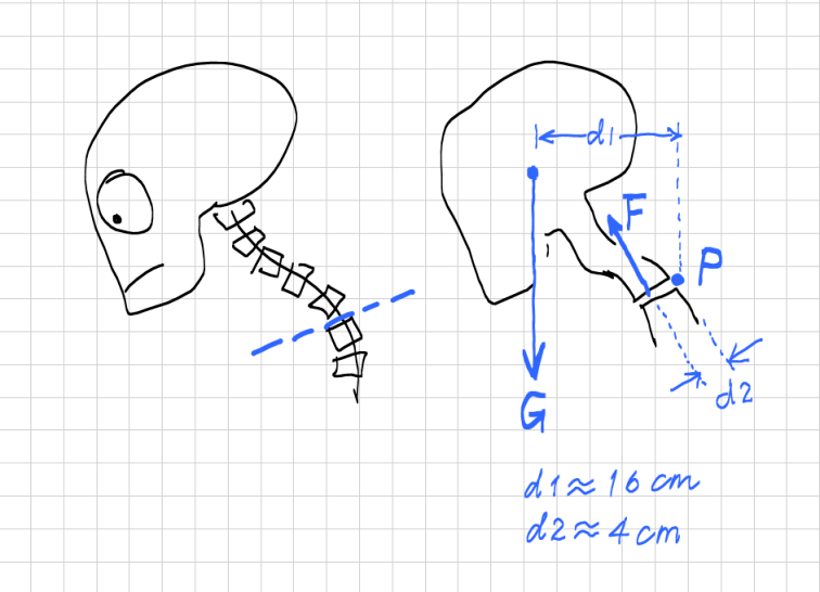 诺总侦破日记低头族颈椎失效模式的技术分析