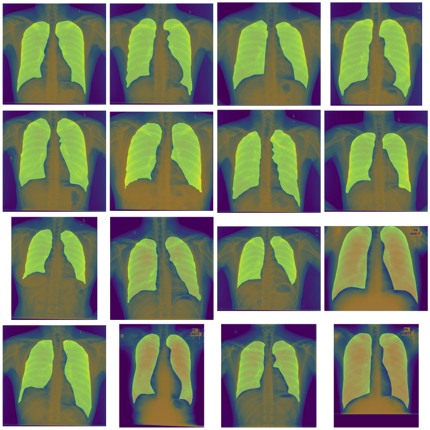 unet 和 unet  :医学影像经典分割网络对比_mask_图像_问题