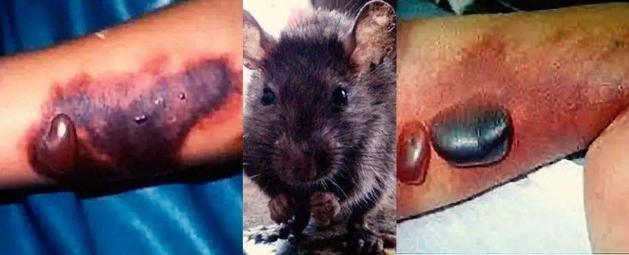 警惕人兽共患的拉沙热,尼日利亚拉沙热疫情致百余人死亡_病毒_排泄物