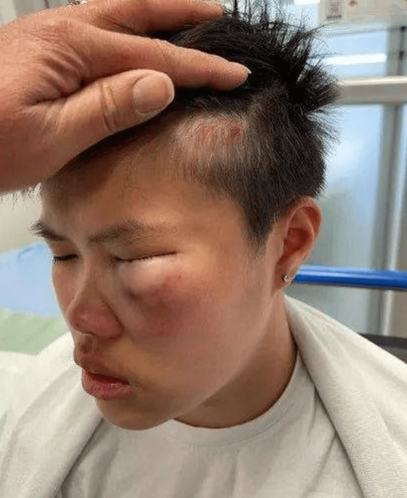 而这一切的起因竟然只是因为男同学整个脸部被打的面目全非.