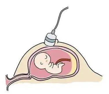 孕妇课堂|四维超声知多少