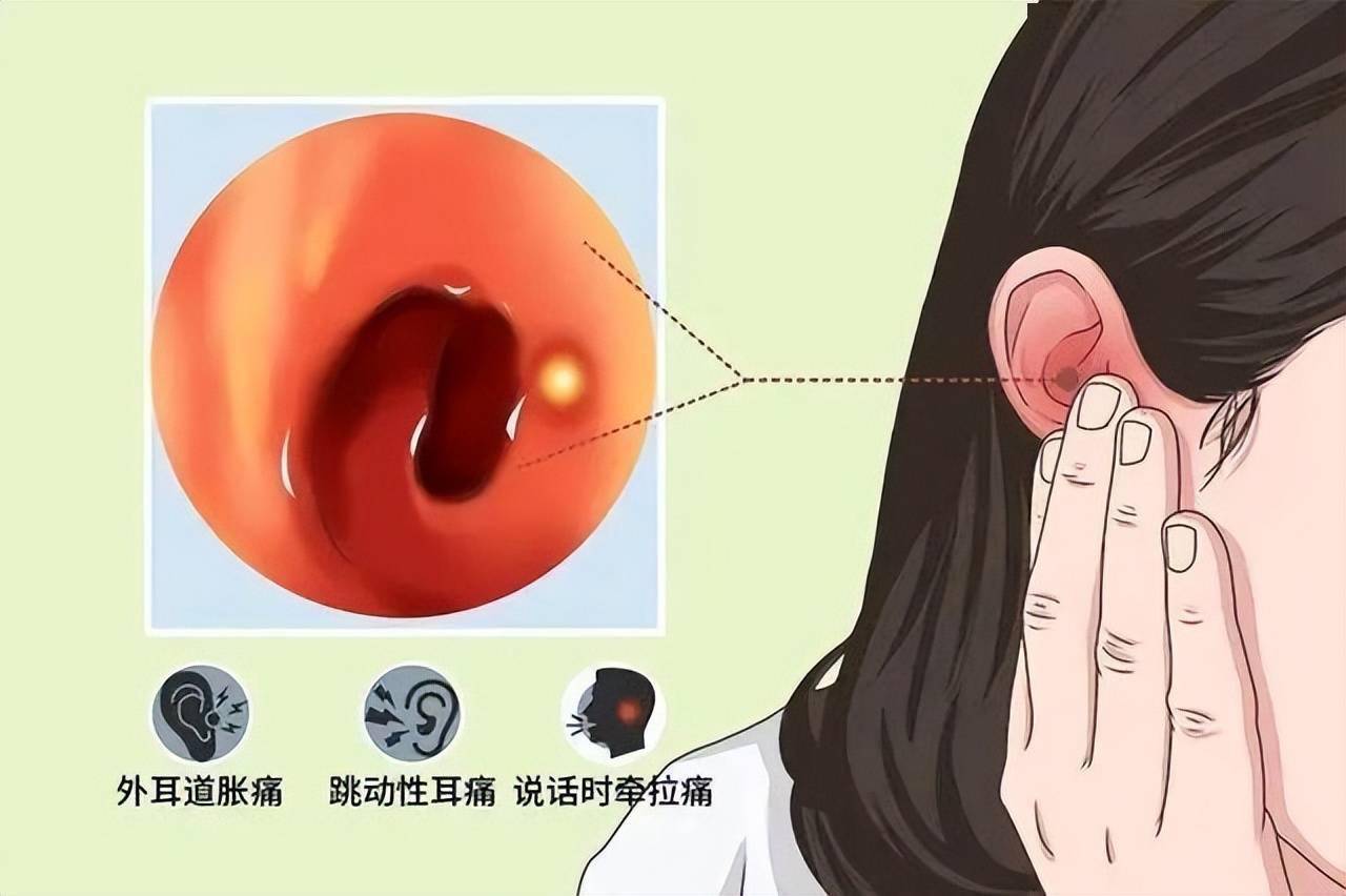 医生提醒耳朵里面经常发痒或是这4种病的表现最好上点心
